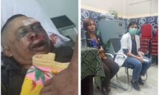 Pasien Sekarat Diduga Diabaikan RSUD Sidikalang Selama Hampir Satu Jam, Jon Berutu Turun Tangan