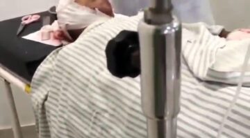 ‎Korban Penganiayaan di Muara Baru OKI Berharap APH Segera Melakukan Penyelidikan