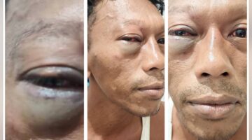 BIADAB! Sengketa Masjid di Gintangan Memanas, Toriq Dihajar Beramai-ramai – Diduga Ada Dalang Oknum Pengacara