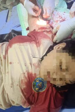 Aksi Heroik Perempuan di Jember Gagalkan Begal Motor Bersenjata Clurit