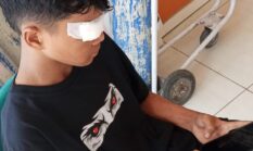 Bukan Luka Kecelakaan, Pelajar di Jember Diduga Dianiaya Usai Tabrakan