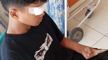 Bukan Luka Kecelakaan, Pelajar di Jember Diduga Dianiaya Usai Tabrakan