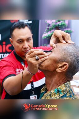 12 Tahun Konsisten, Program Katarak Gratis Banyuwangi Sentuh Ribuan Warga