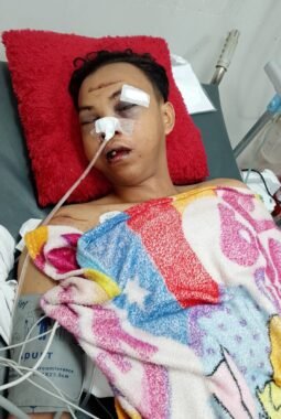 Kecelakaan di Depan Pabrik New Hope, Mobil Antre Bongkar di Bahu Jalan Diminta Ditertibkan