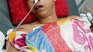 Kecelakaan di Depan Pabrik New Hope, Mobil Antre Bongkar di Bahu Jalan Diminta Ditertibkan